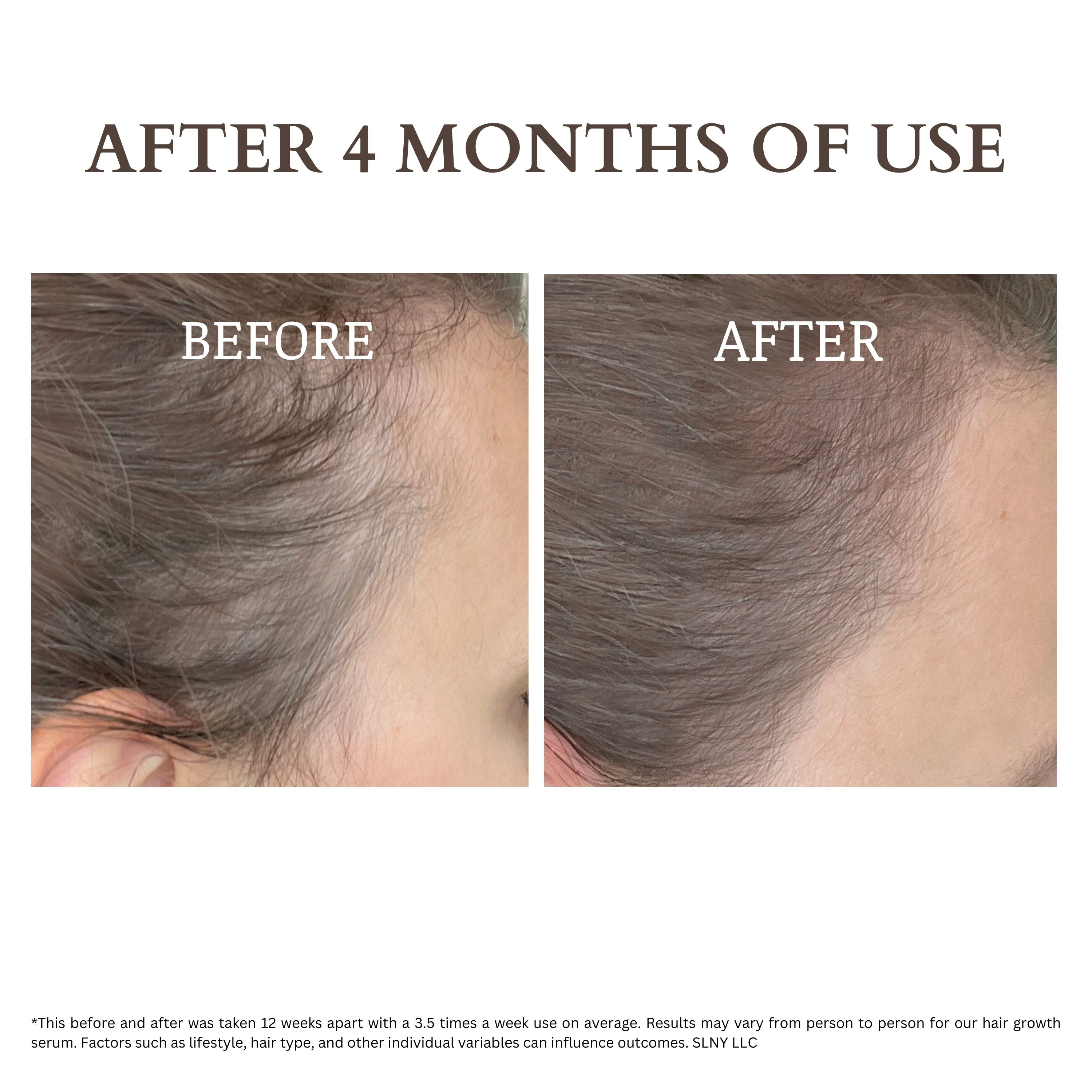 HAIR BOOST KIT Anti-hair Loss Serum Treatment Set ($119 value)