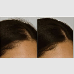 Intensive LED Red Light Therapy Headband: Support Growth and Strength