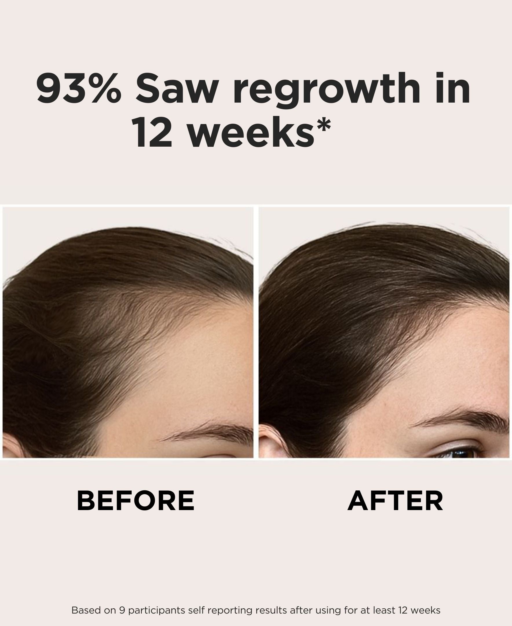 Intensive LED Red Light Therapy Headband: Support Growth and Strength