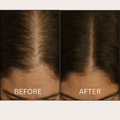 New! OOO LED Hair Growth Hat PRO Supporting Growth