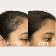 Intensive LED Hair Growth Stimulating Brush: Reduce Shedding